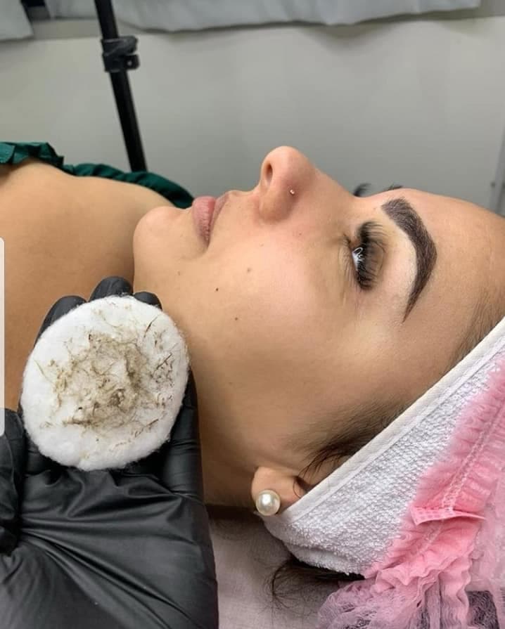 Una exfoliación rejuvenecedora que deja la piel suave, fresca y revitalizada. El primer paso hacia una piel radiante y llena de luminosidad.