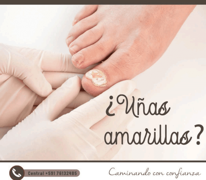 Cuidado preventivo de problemas podológicos.