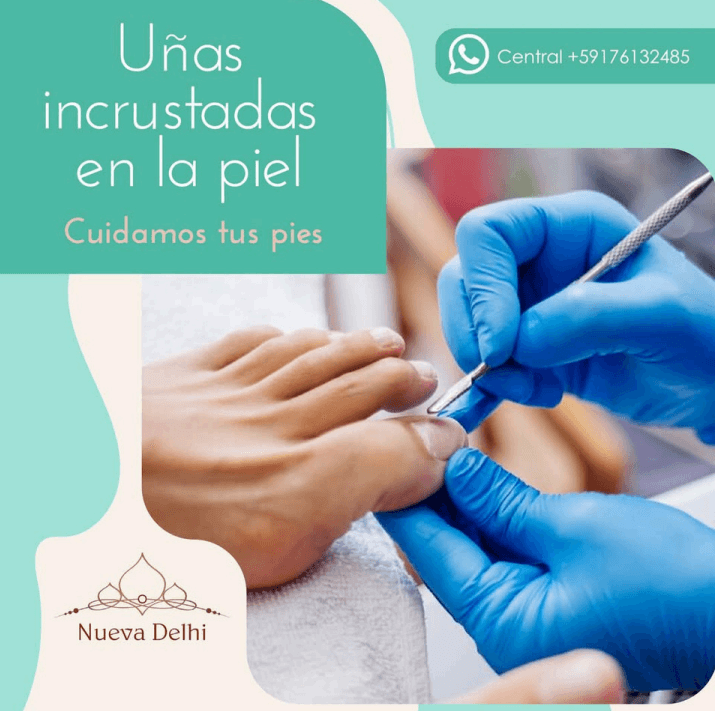 Tratamiento especializado para callos y durezas.